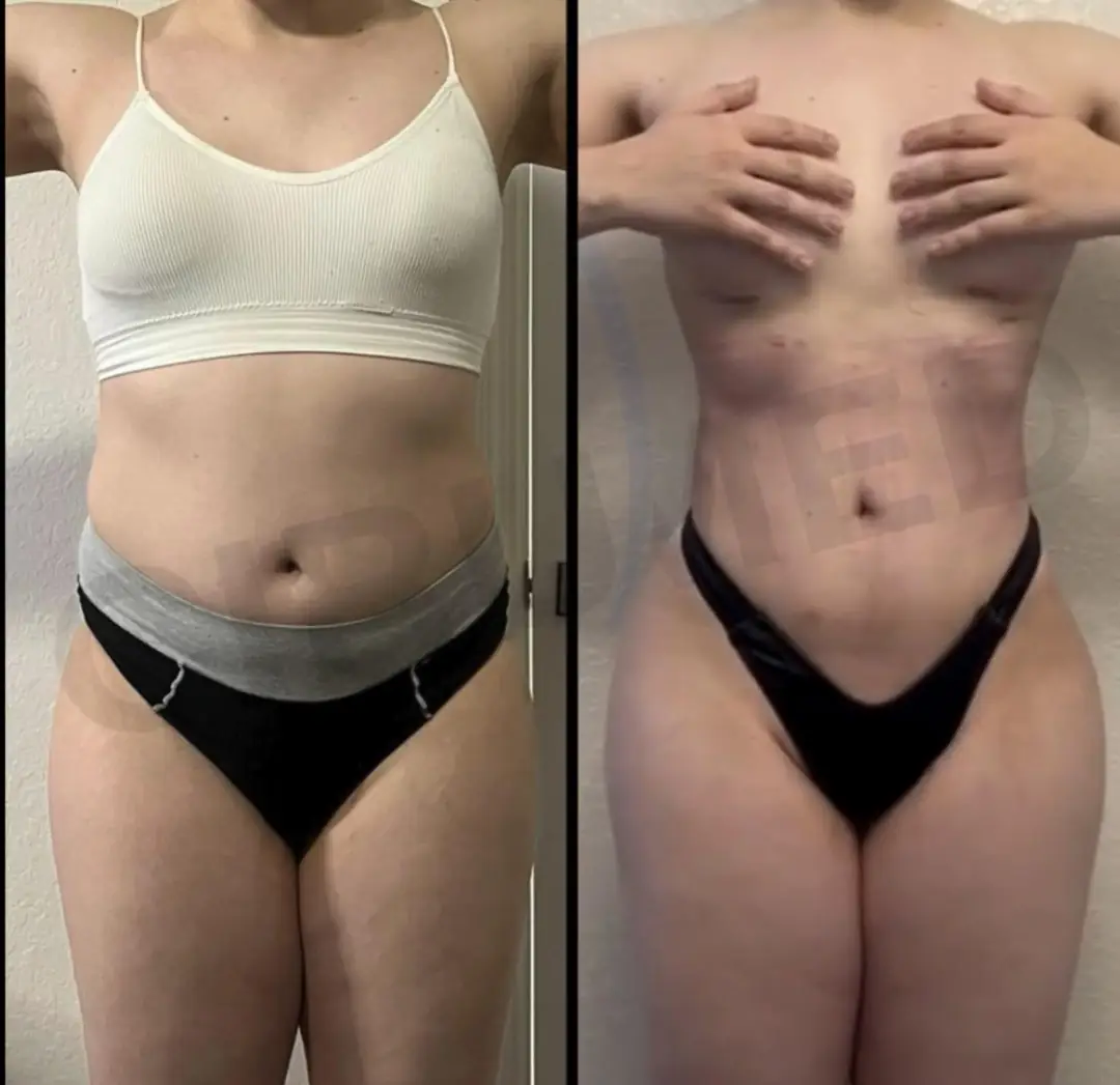 3ml of Plastic Perfection: Transforming This Rectangle into a Fucking Incredible Goddess