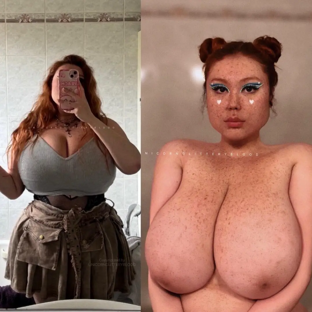 Asian Beauty: My Freckles, Your Obsession?
