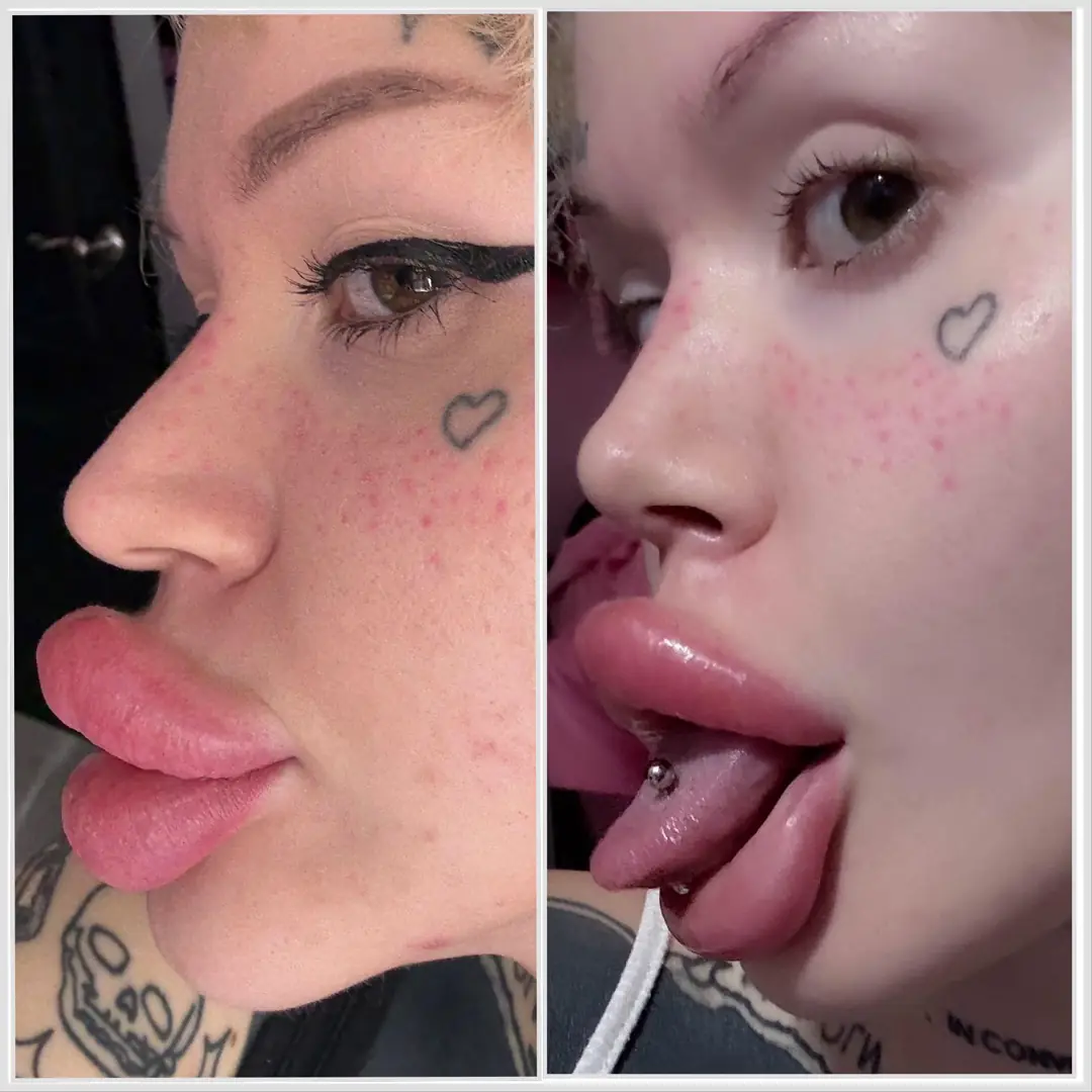 Freshly bimbofied with a cute new nose and massive cock pillow lips begging for a stretch