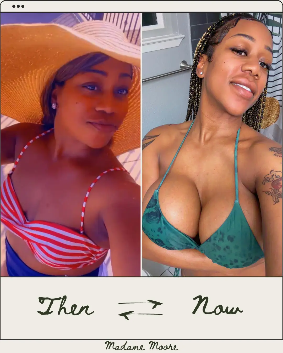 From Average Girl To Filthy Beauty Idol: My V-Line Transformation And 2800cc Dream Fantasy