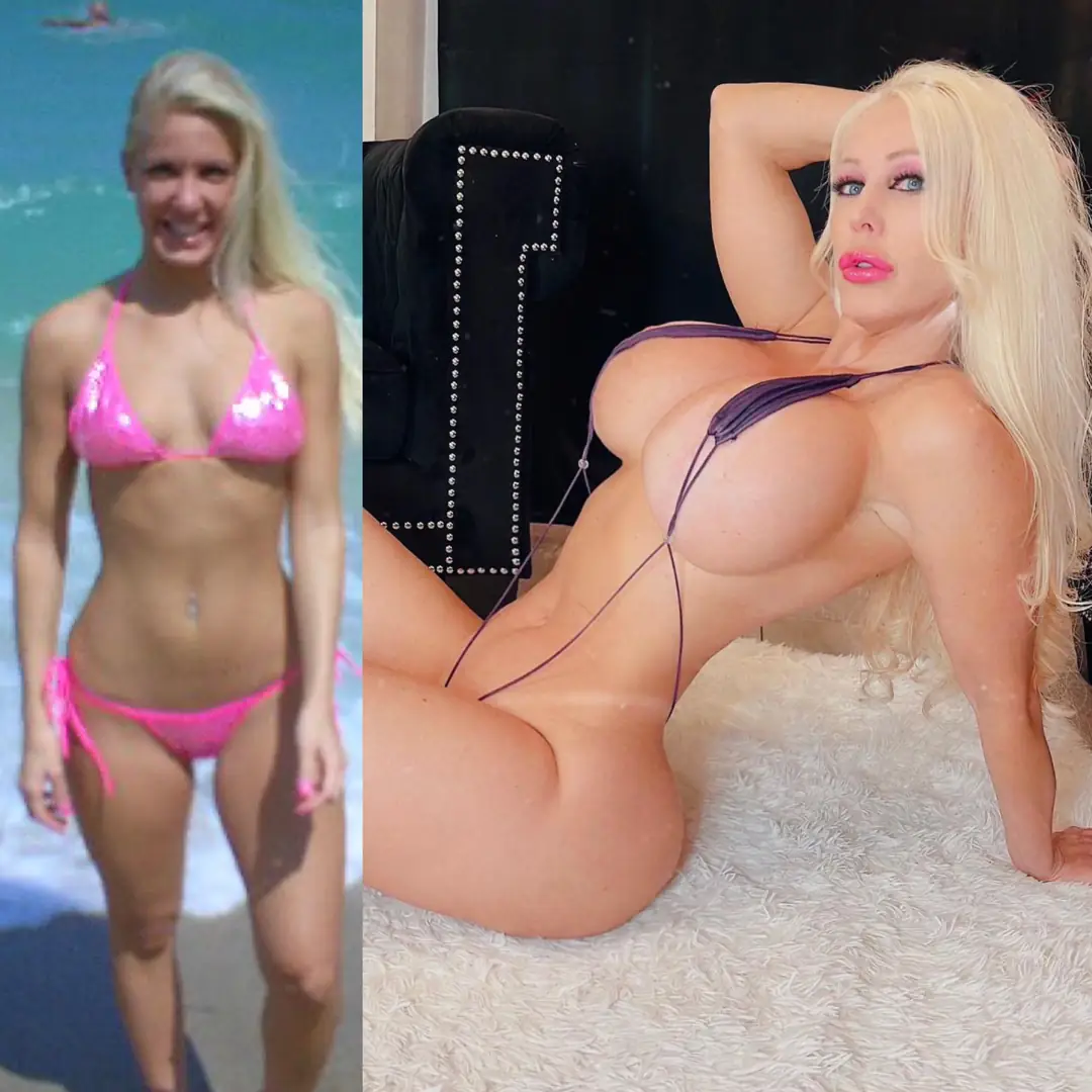 From Tiny A Cup to 1500cc Bimbo Tits: Help Me Decide How Much Bigger to Go