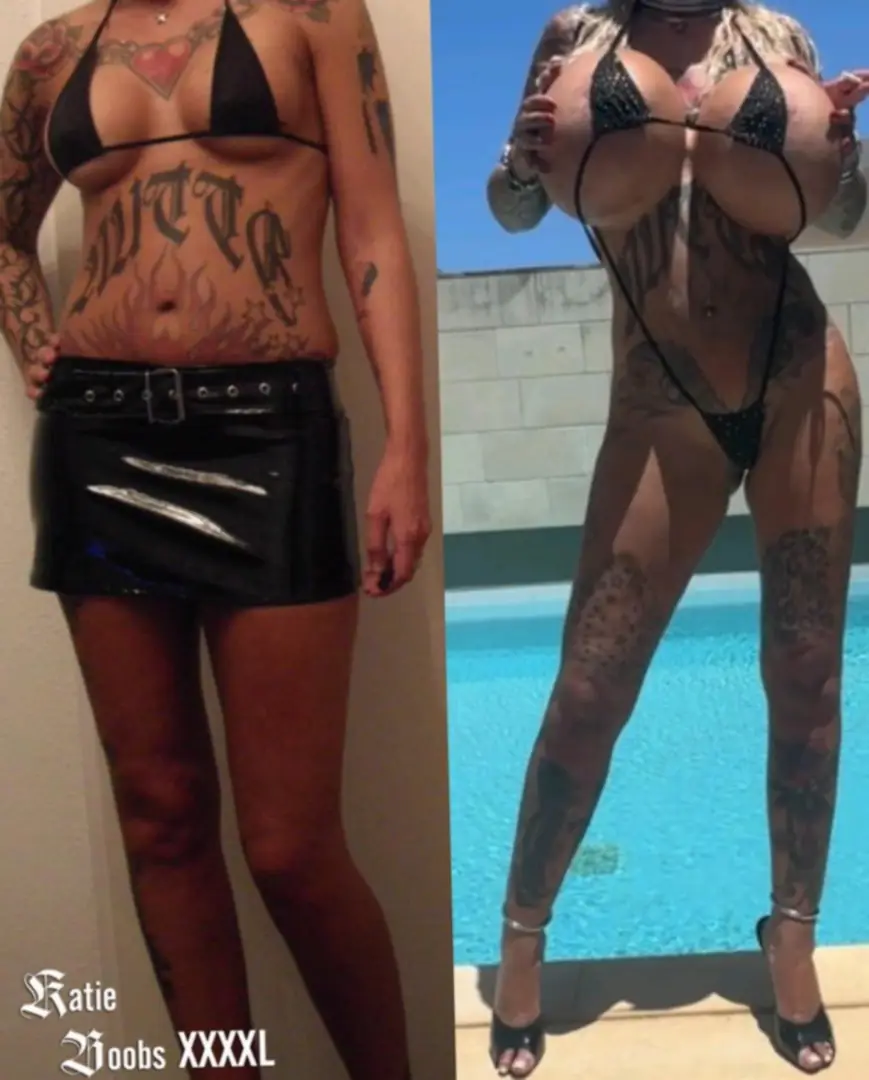 From hot to bimbo perfection: My 2800cc transformation is just getting started