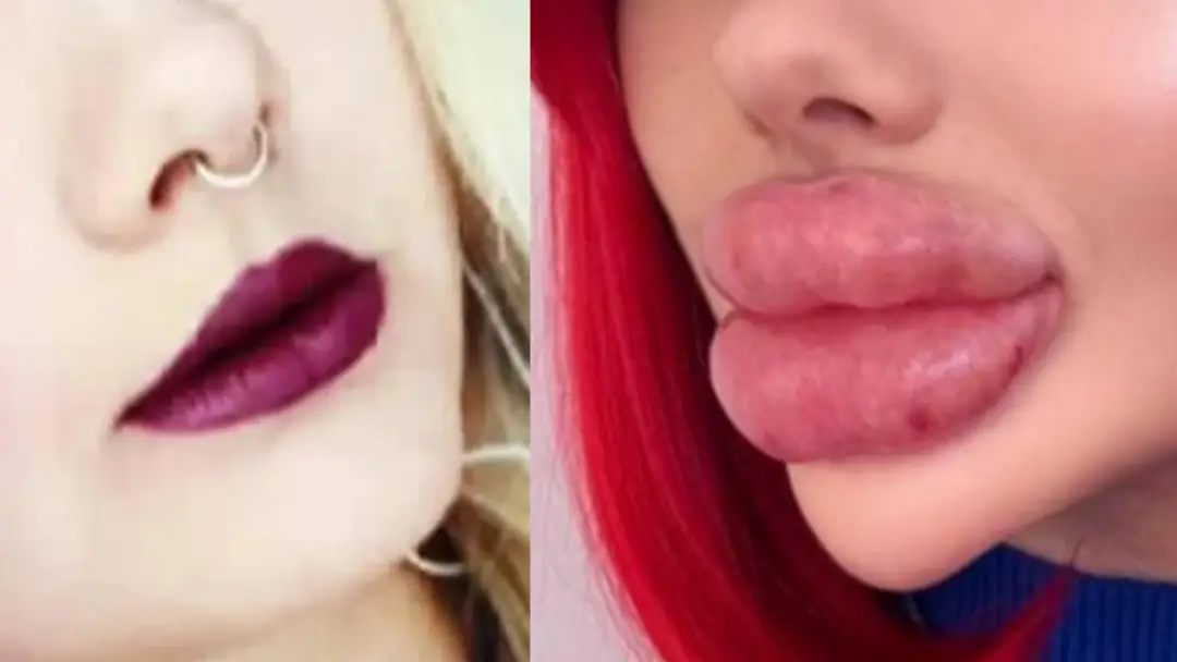 Leveling up my bimbo look from 0ml to a gorgeous blonde Barbie goddess with heavy lips and tits