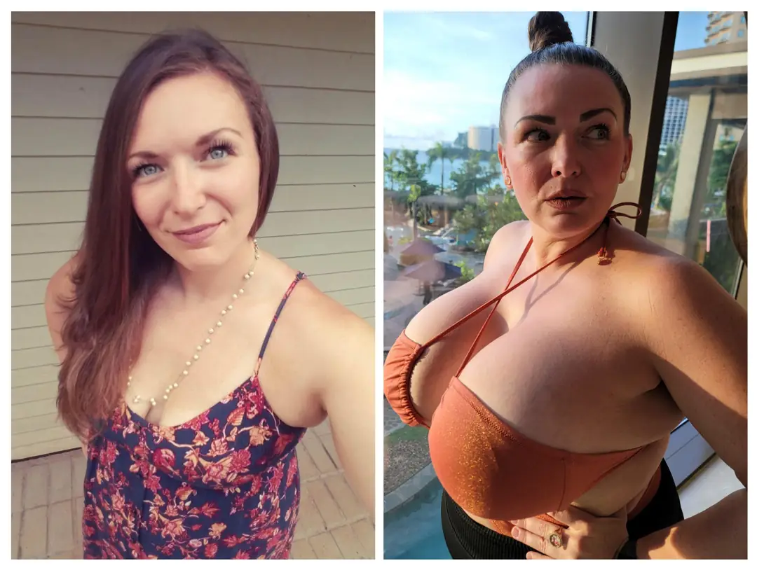 Making 3500cc Look Small: 30 Days Until I Have an Enormous Orgasmic Rack Bigger Than My Torso