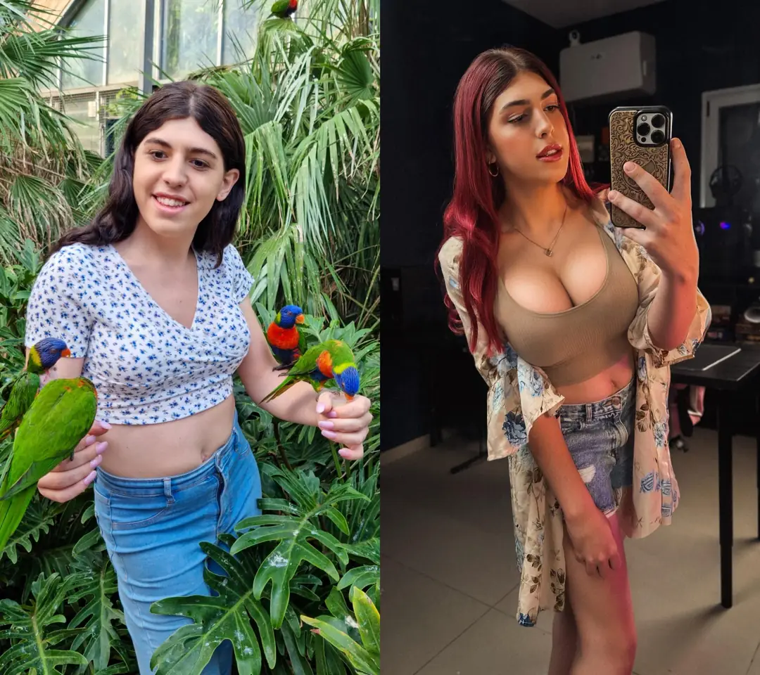 Massive transformation: My gorgeous new tits and this incredible glow up