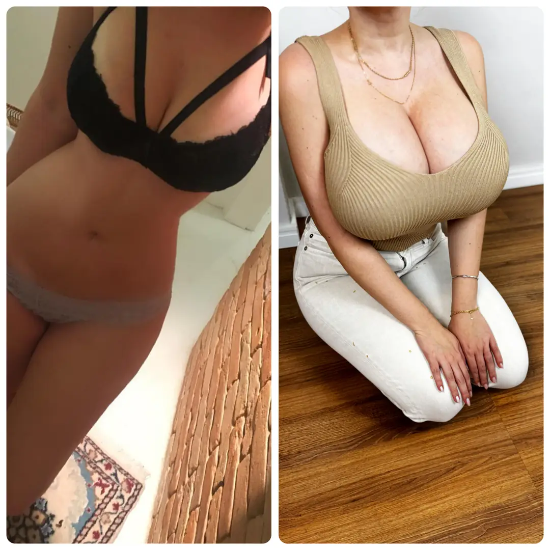 Massive upgrade: these delicious melons defy gravity and demand your attention