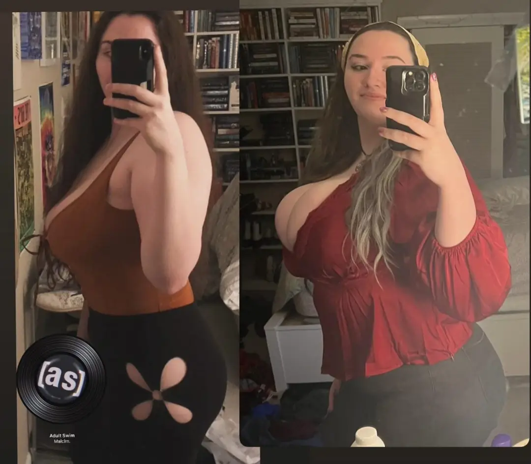 Mood Boobs & Body Transformation: My Wildest Dreams Come True!
