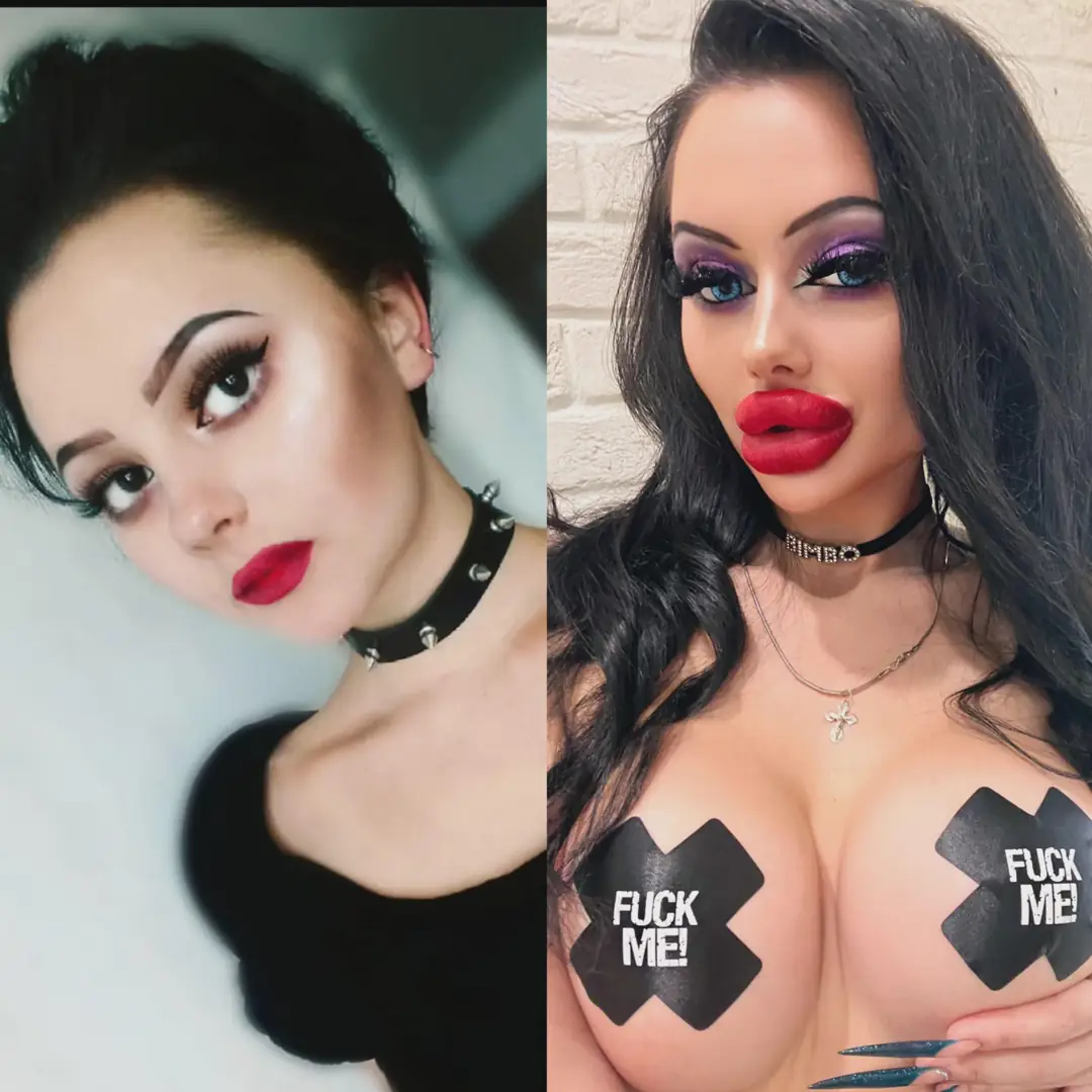 My Ultimate Plastic Bimbo Transformation: 400cc Silicone Tits and Fuckdoll Perfection