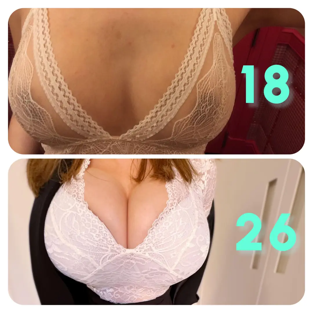 My bimbofication journey: Loving these huge new implants and this sexy progress