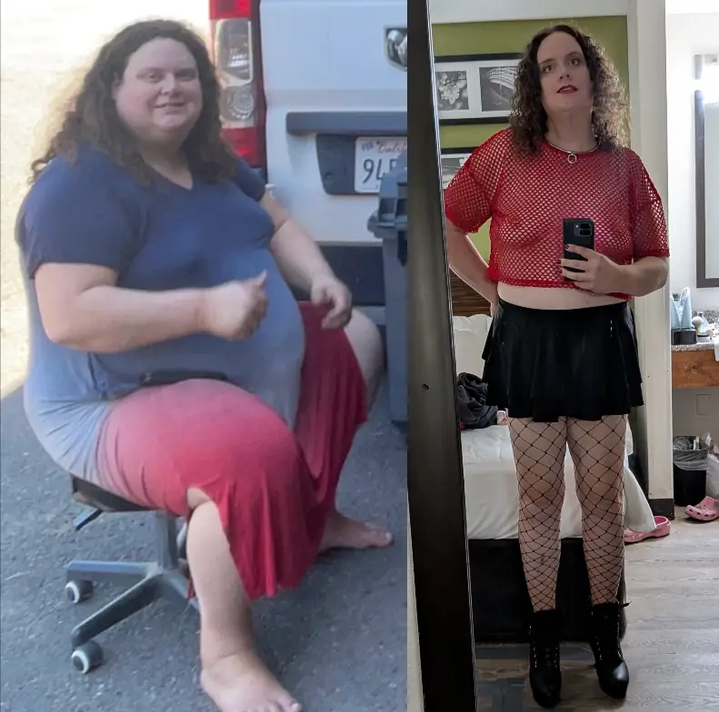 My crazy bimbofication transformation is just getting started and I am craving filler and implants