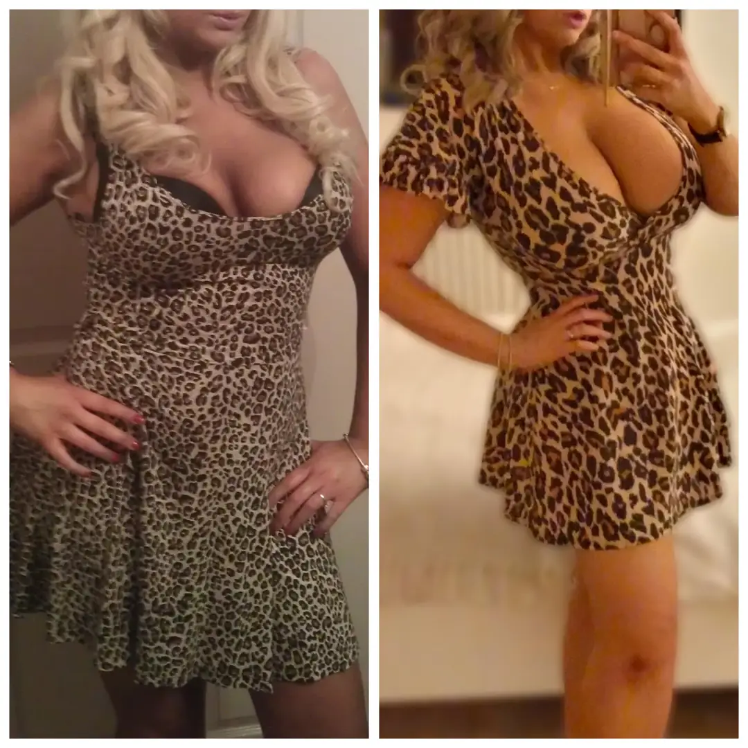 My stunning 32GG transformation proves that bigger is always better and damn good looking