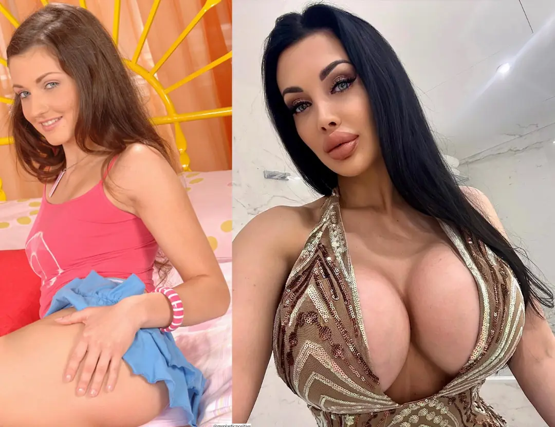Plastic Fuck Doll Goals: My Slutty Bimbo Transformation and Lip Filler Obsession