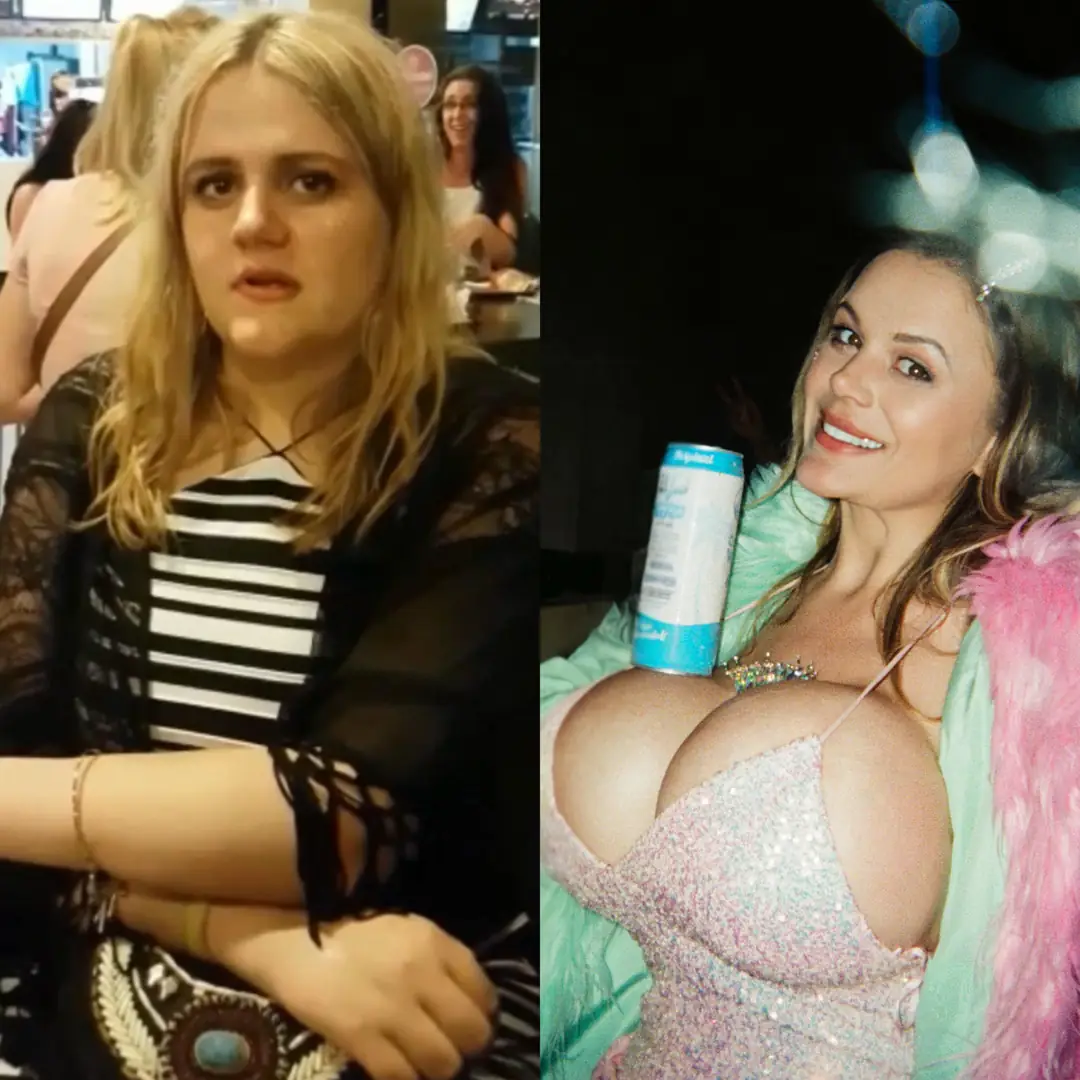 Plastic is Fantastic: My Stunning Glow Up from Boring and Average to Beyond Perfect