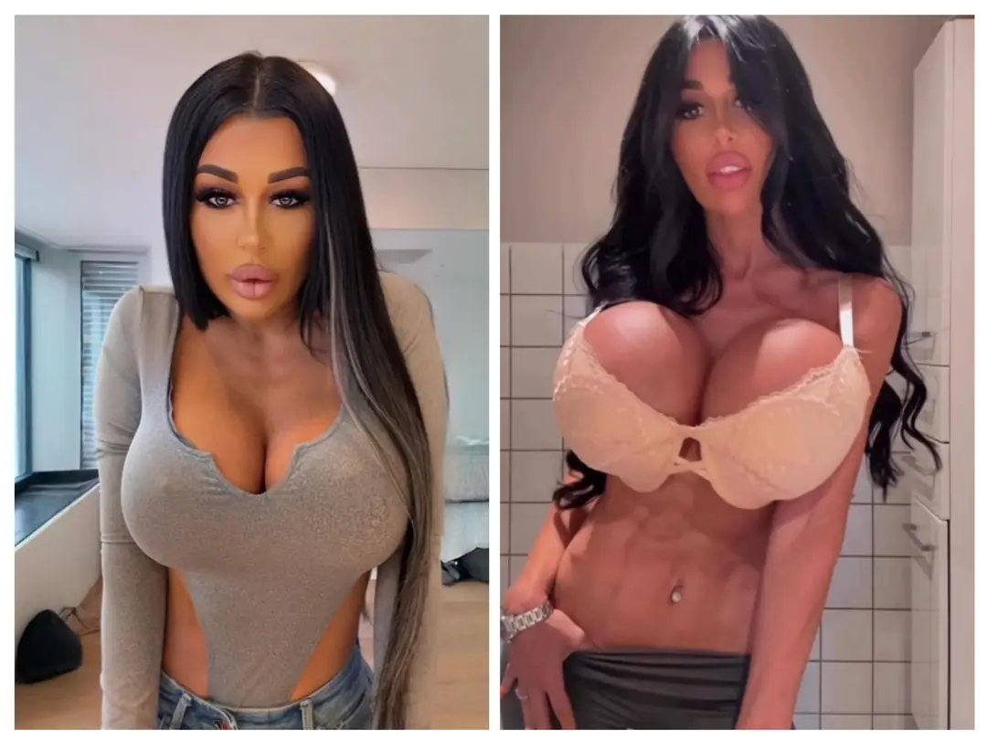 Selena Black: Going Huge with Massive 2800cc Implants and Snatched Russian Lips