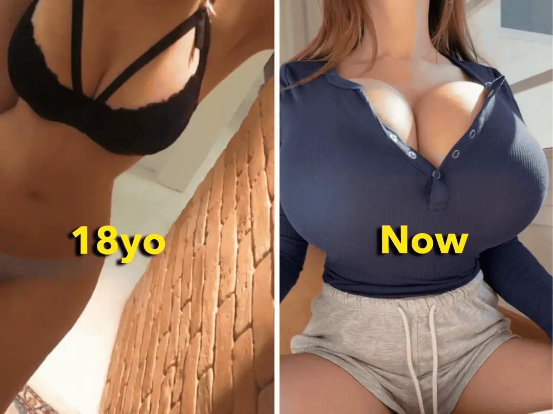 Skinny With Fantastic Huge Tits and Naughty Lopsided Growth