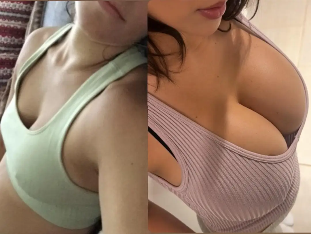 Thick Lips and Sexy Round Upgrades for the Ultimate Bimbo Transformation